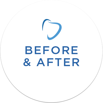 Dental Before and After Pictures in Silver Spring & Germantown, MD