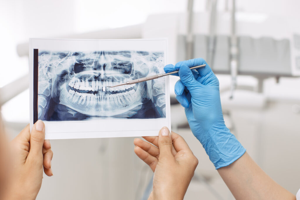 Lakeside smile Dentist showing X-ray image to patient. People, medicine, stomatology, technology and health care concept - happy female dentist with teeth x-ray image and patient woman at dental clinic office. No face, only hands close-up.